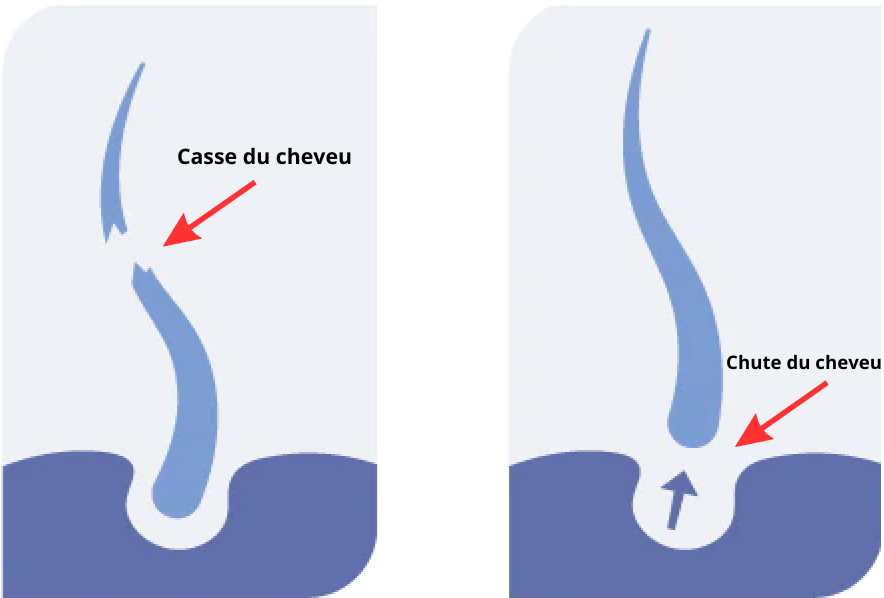 Quelle est la différence entre la chute et la casse des cheveux crépus